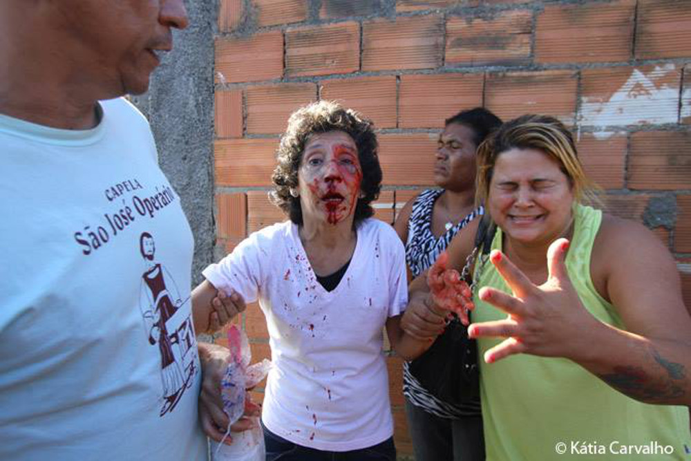 Moradora foi agredida por policiais. Foto: Katia Carvalho